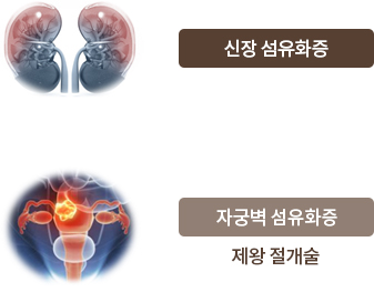 조직공학 치료제 연구 이미지2